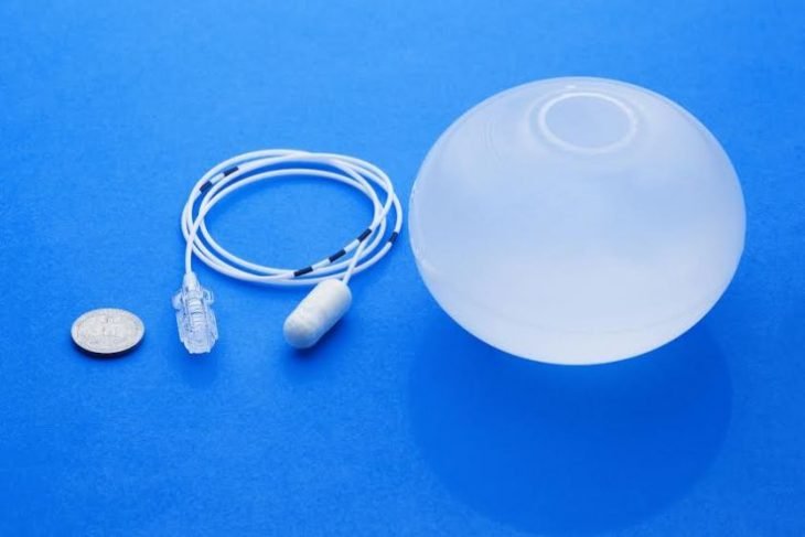 Allurion D voile Une Pilule Rempla ant La Chirurgie De Bypass
