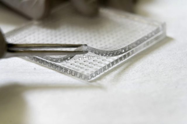 Un patch à micro-aiguilles pénètre les biofilms pour traiter les plaies chroniques