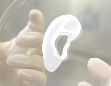 AuriNovo - Des implants d'oreille imprimés en 3D