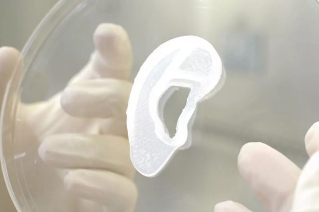 AuriNovo - Des implants d'oreille imprimés en 3D