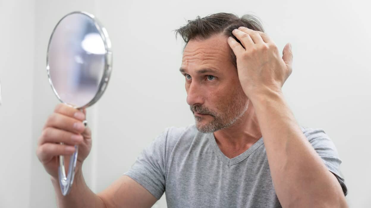 Des scientifiques auraient découvert par hasard un remède contre la calvitie